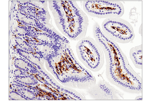  Image 27: Mouse Reactive M1 vs M2 Macrophage IHC Antibody Sampler Kit