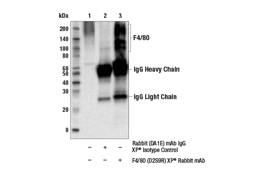 Image 51: Mouse Reactive M1 vs M2 Macrophage IHC Antibody Sampler Kit
