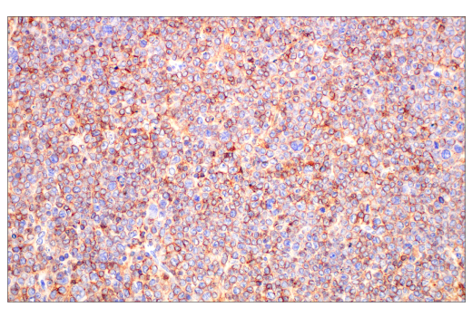 Immunohistochemistry Image 5: CD20 (E3N7O) XP® Rabbit mAb