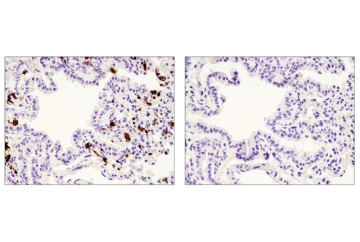 Immunohistochemistry Image 3: CD45 (D3F8Q) Rabbit mAb