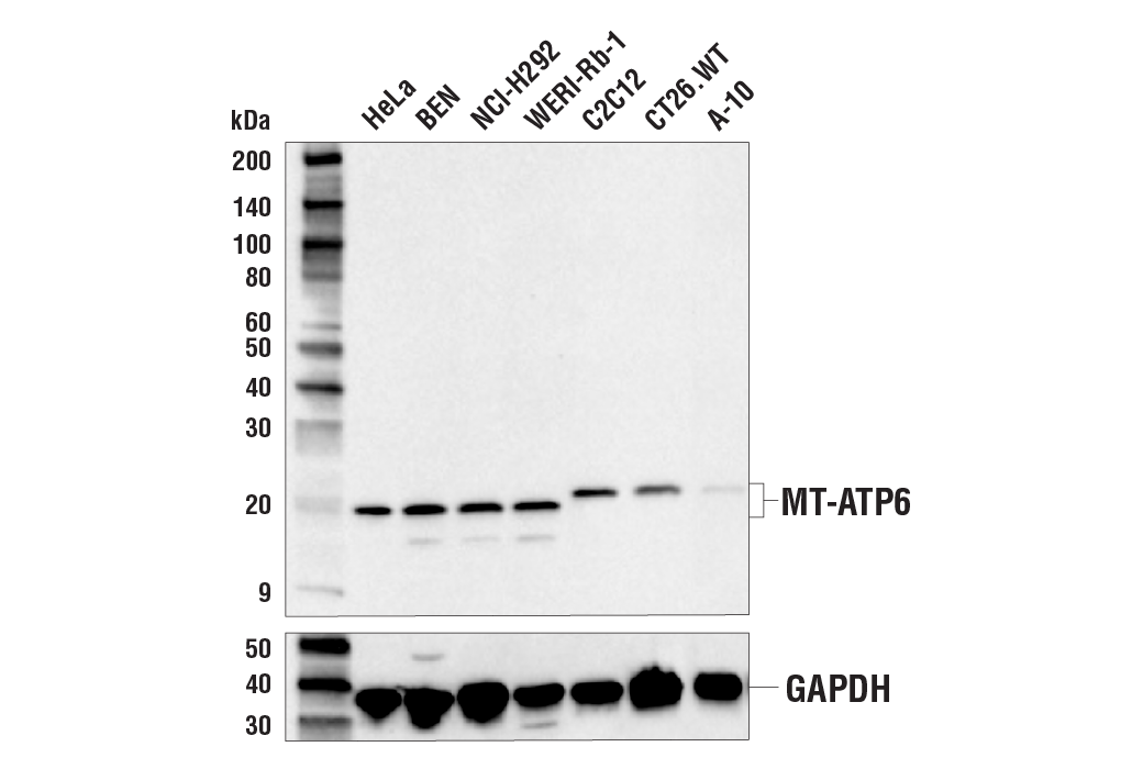 Western Blotting Image 2: MT-ATP6 Antibody