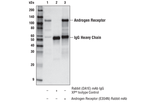 Immunoprecipitation Image 1: Androgen Receptor (E3S4N) Rabbit mAb (Carboxy-terminal Antigen)