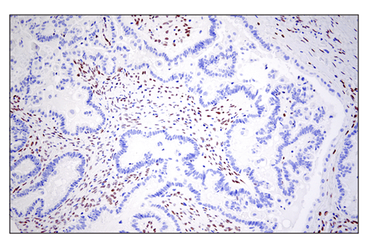  Image 39: Epithelial-Mesenchymal Transition (EMT) IF Antibody Sampler Kit