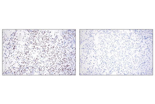  Image 58: Epithelial-Mesenchymal Transition (EMT) IF Antibody Sampler Kit