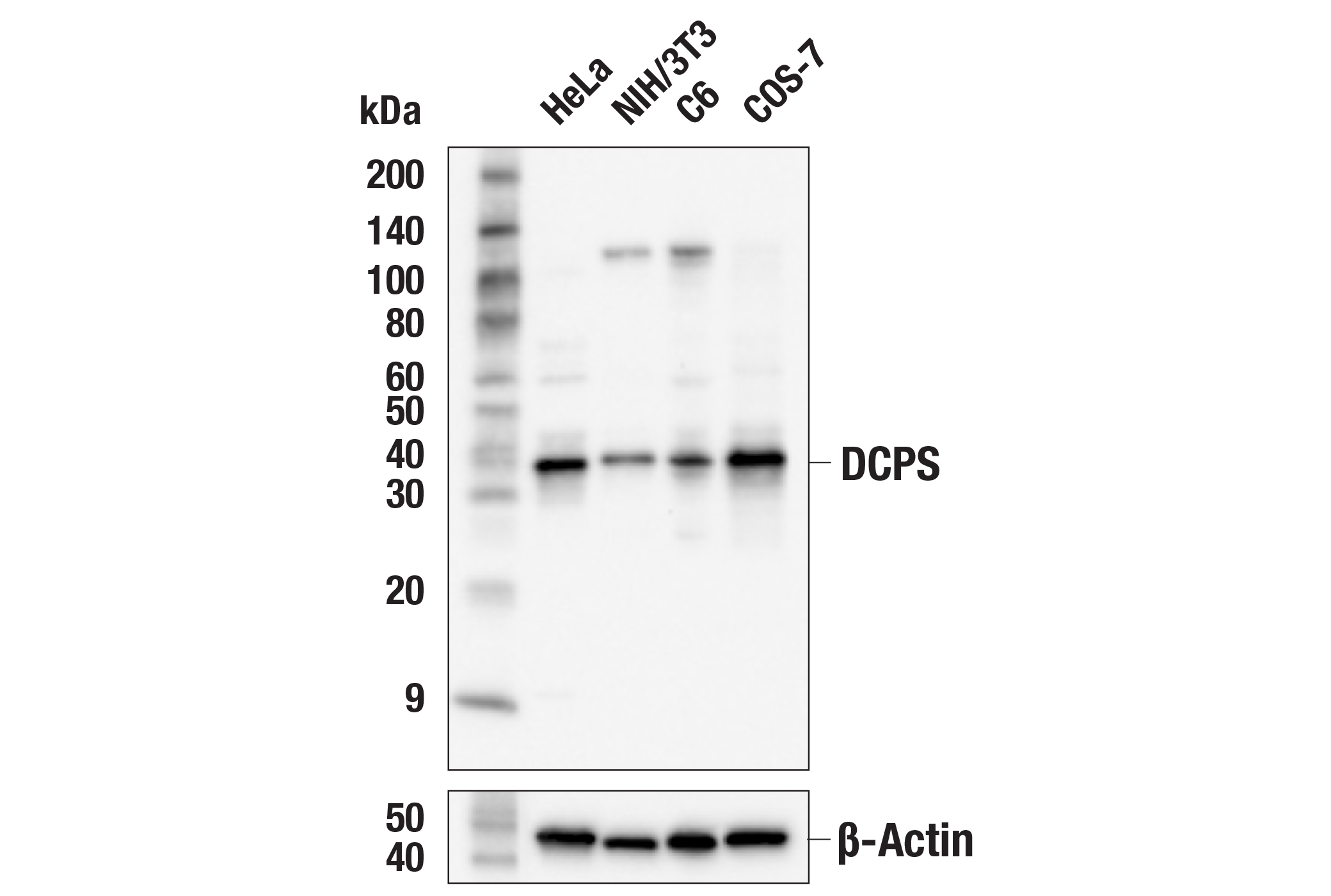 Western Blotting Image 1: DCPS (E3A4Q) Rabbit mAb