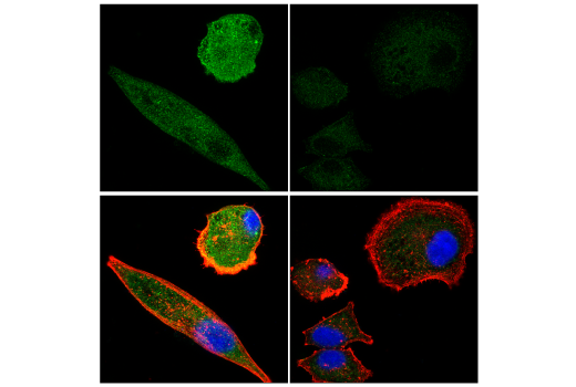 Immunofluorescence Image 4: Calpain 2 Large Subunit (M-type) (E3M6E) Rabbit mAb