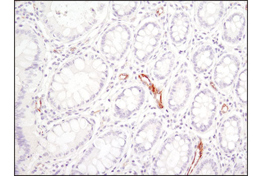 Immunohistochemistry Image 1: SPARC (D10F10) Rabbit mAb (BSA and Azide Free)