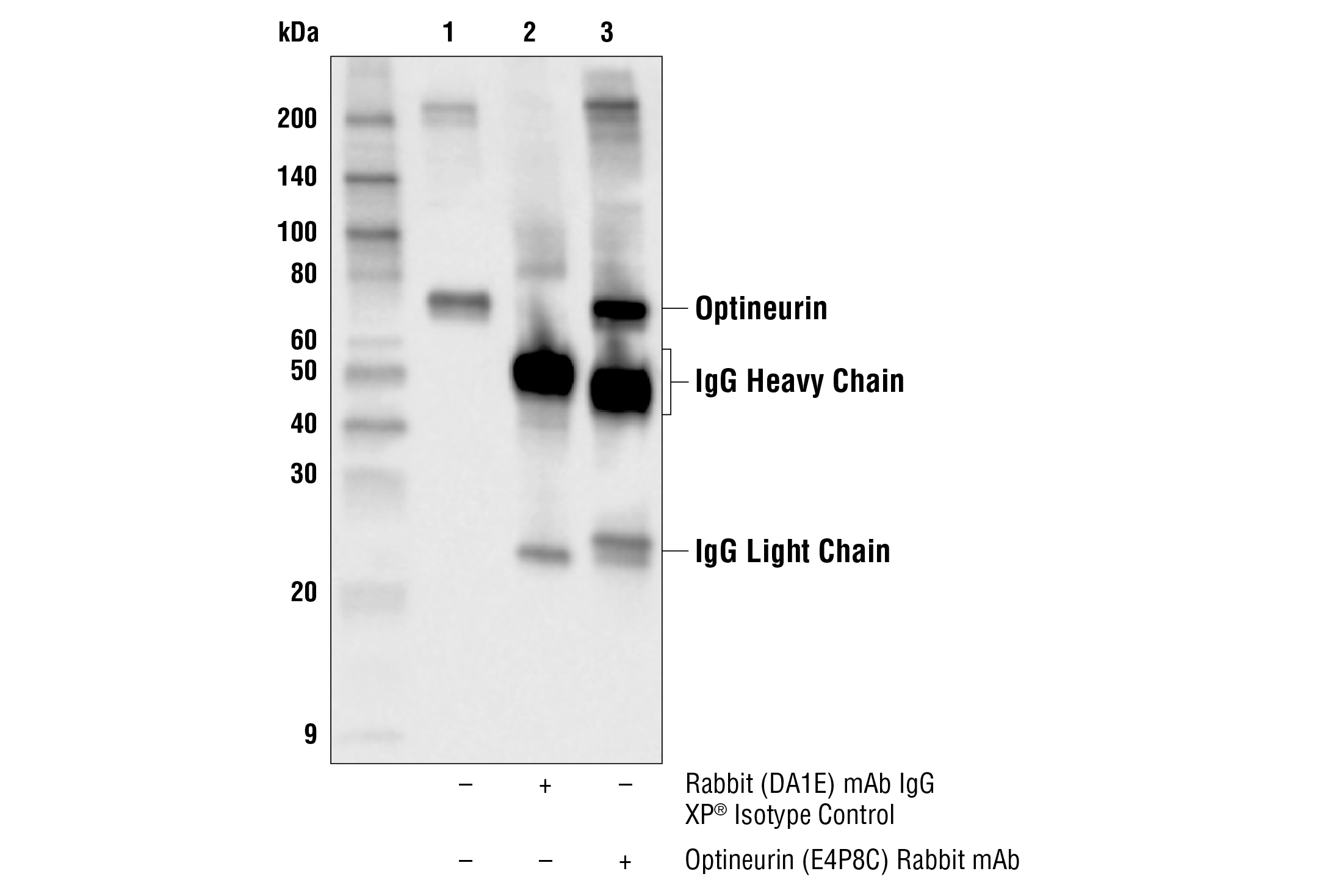 Immunoprecipitation Image 1: Optineurin (E4P8C) Rabbit mAb