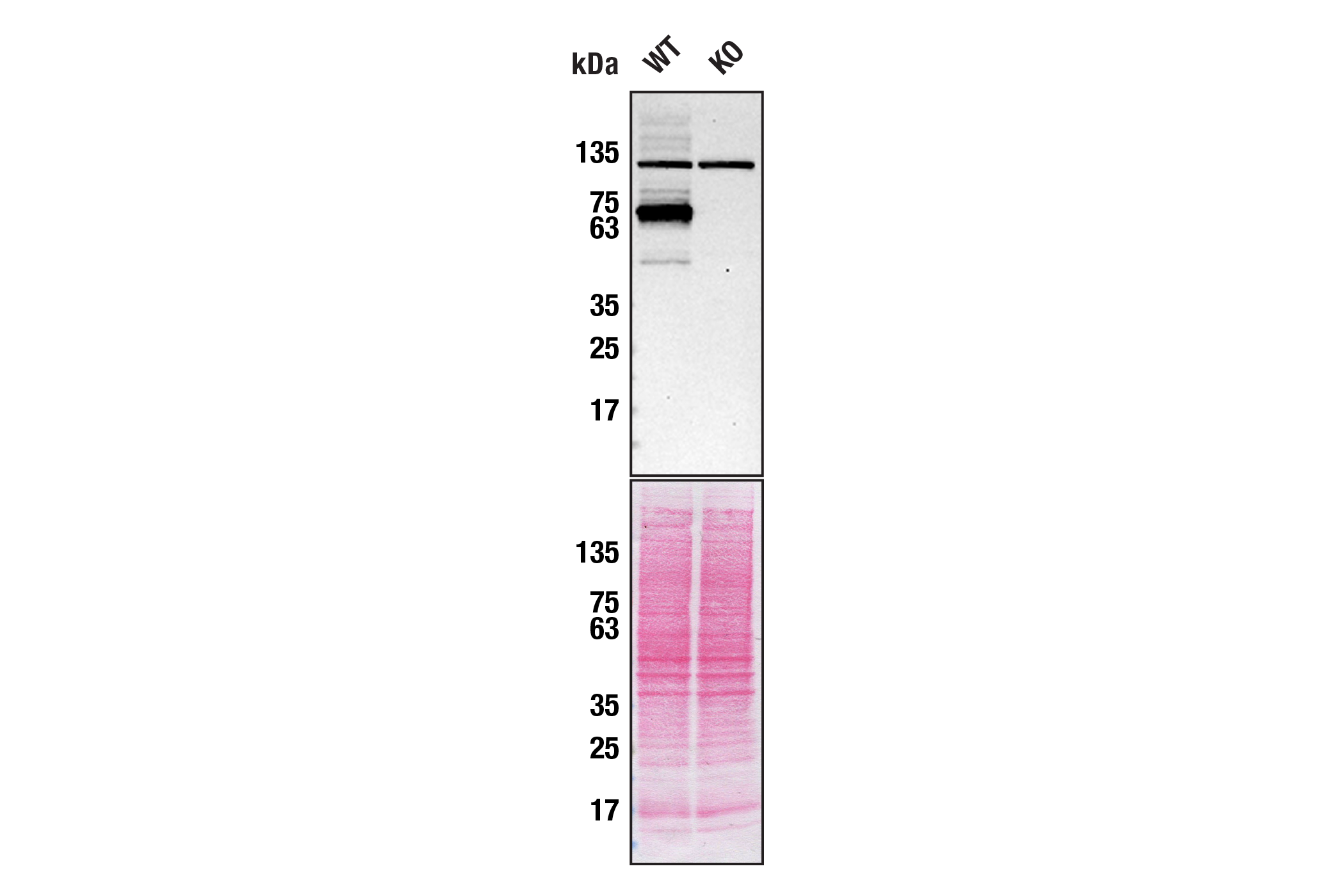  Image 4: PhosphoPlus® Optineurin (Ser177) Antibody Duet