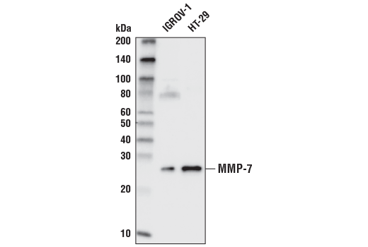 Western Blotting Image 1: MMP-7 Antibody