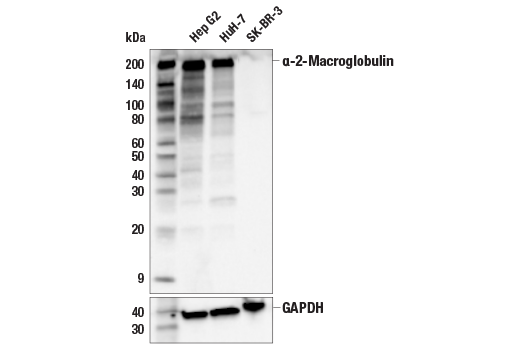 Western Blotting Image 1: α-2-Macroglobulin (E4H4U) Rabbit mAb
