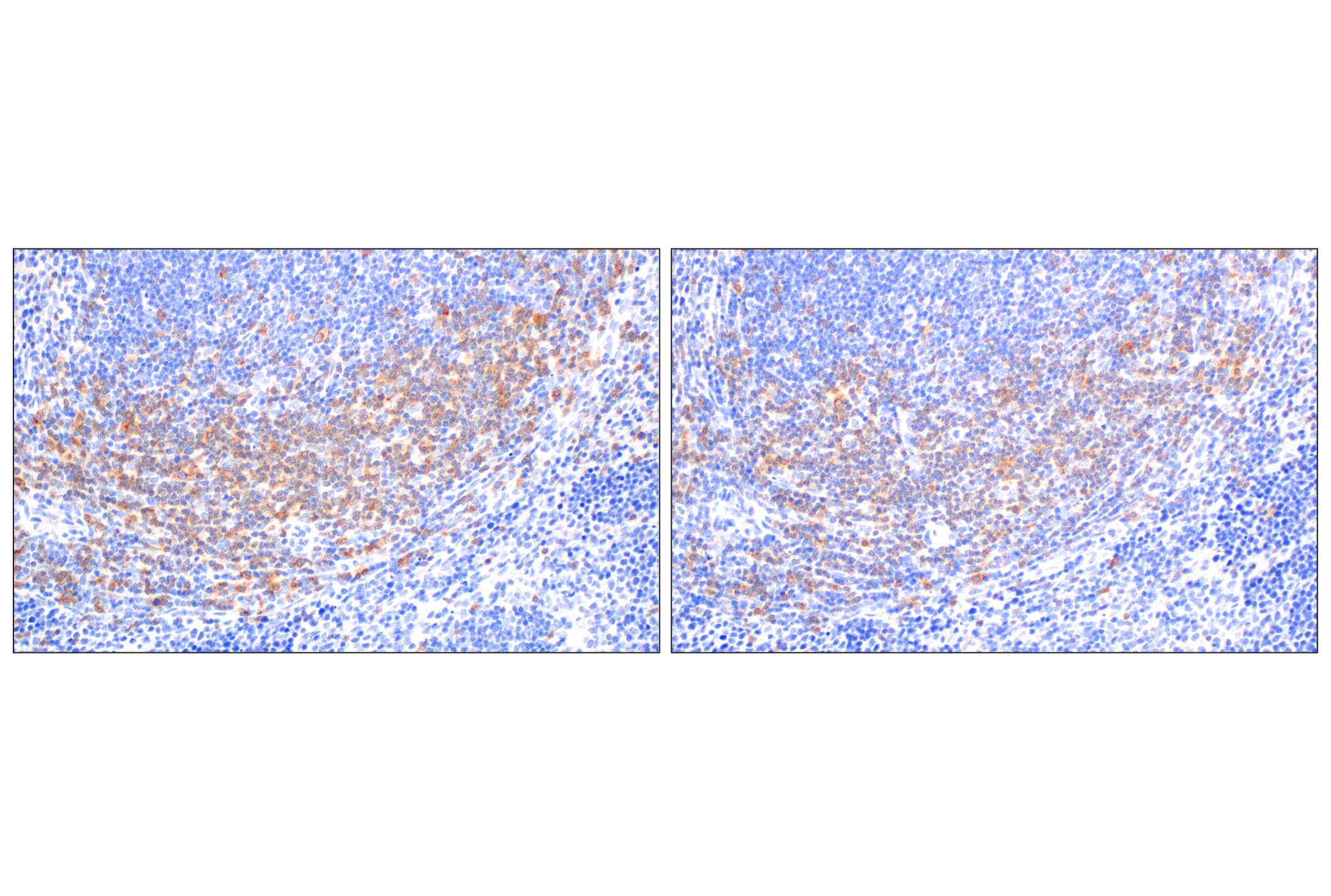 Immunohistochemistry Image 6: CD27 (F3R2V) Rabbit mAb