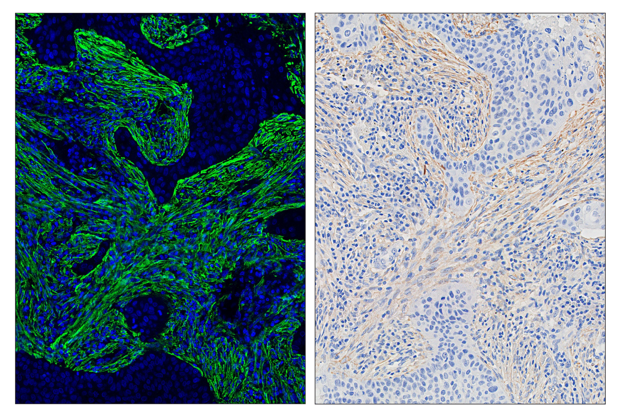 Immunohistochemistry Image 6: α-Smooth Muscle Actin (D4K9N) & CO-0024-750 SignalStar™ Oligo-Antibody Pair