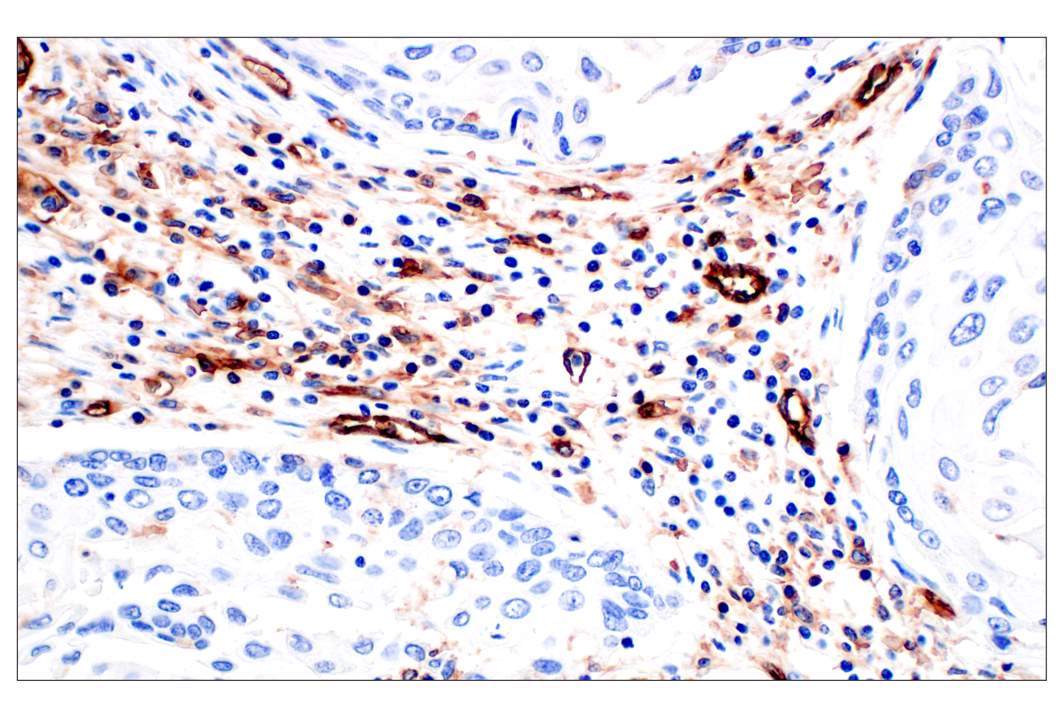 Immunohistochemistry Image 6: CD31 (PECAM-1) (F8M3S) Rabbit mAb (BSA and Azide Free)