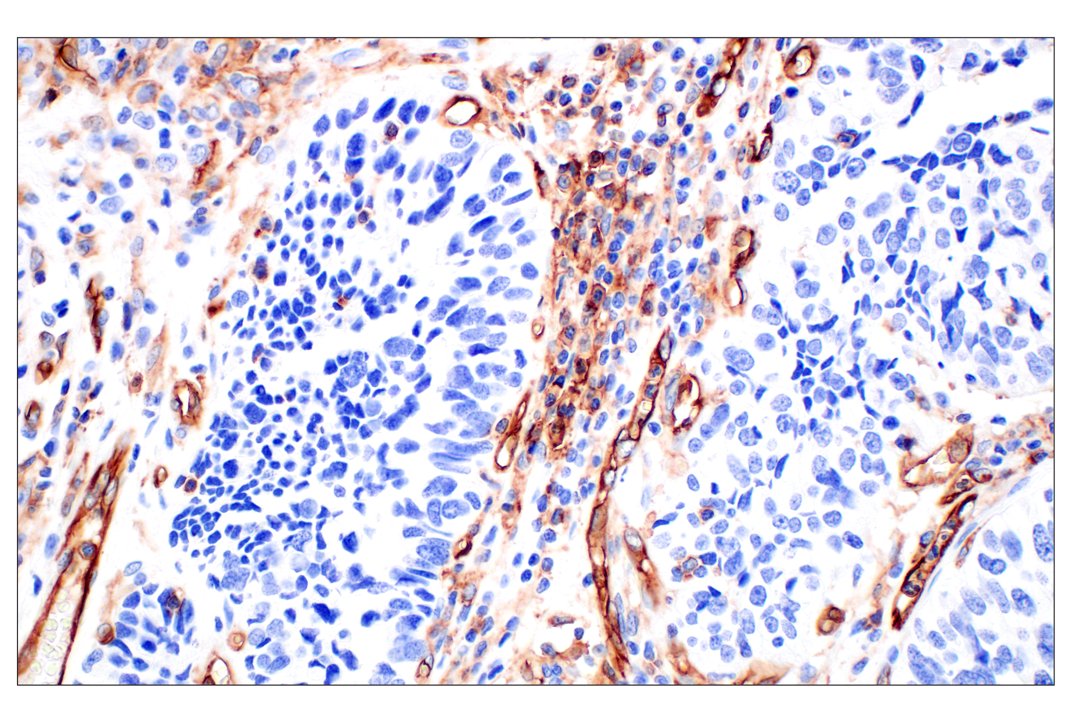 Immunohistochemistry Image 5: CD31 (PECAM-1) (F8M3S) Rabbit mAb (BSA and Azide Free)