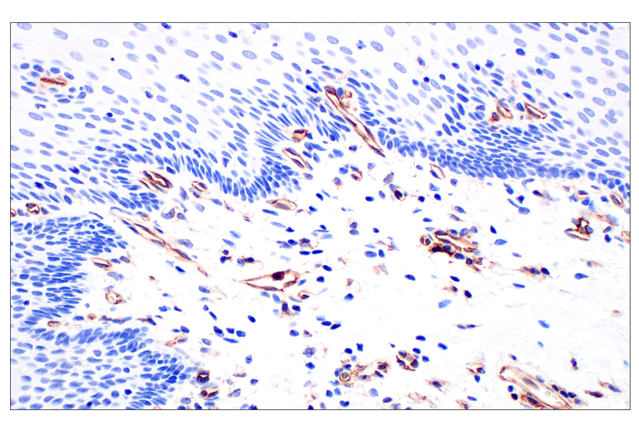 Immunohistochemistry Image 10: CD31 (PECAM-1) (F8M3S) Rabbit mAb (BSA and Azide Free)