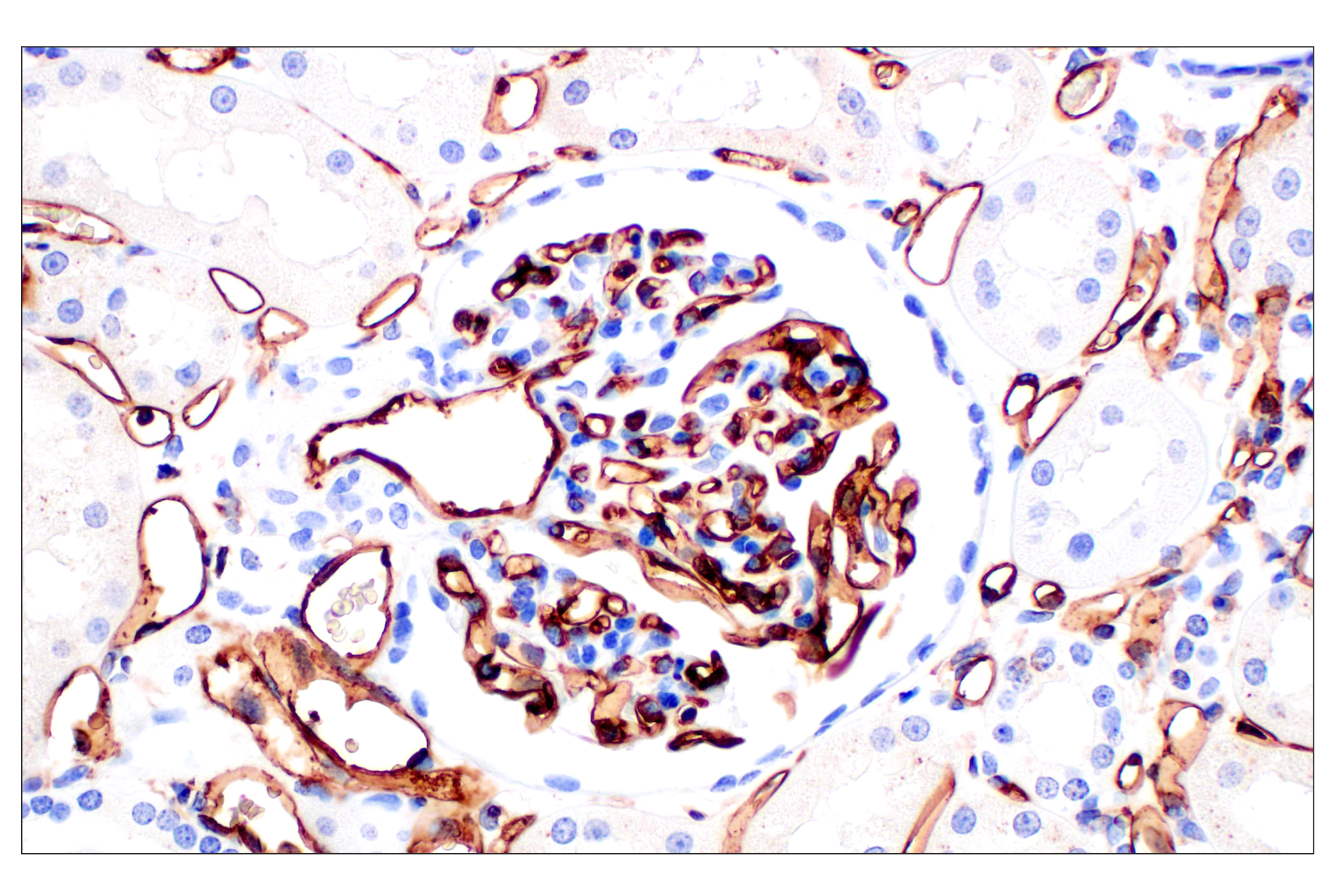 Immunohistochemistry Image 4: CD31 (PECAM-1) (F8M3S) Rabbit mAb (BSA and Azide Free)