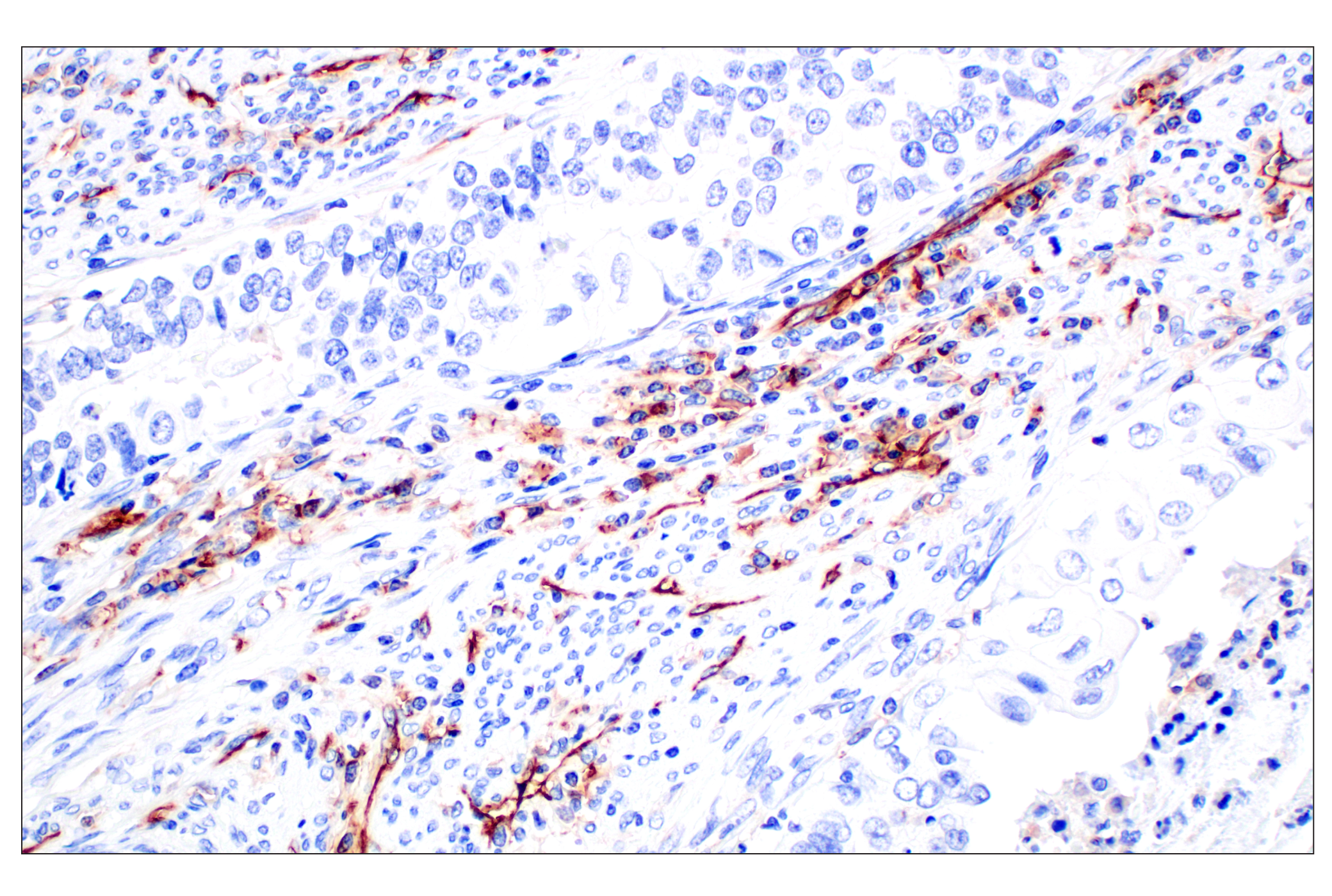 Immunohistochemistry Image 9: CD31 (PECAM-1) (F8M3S) Rabbit mAb (BSA and Azide Free)