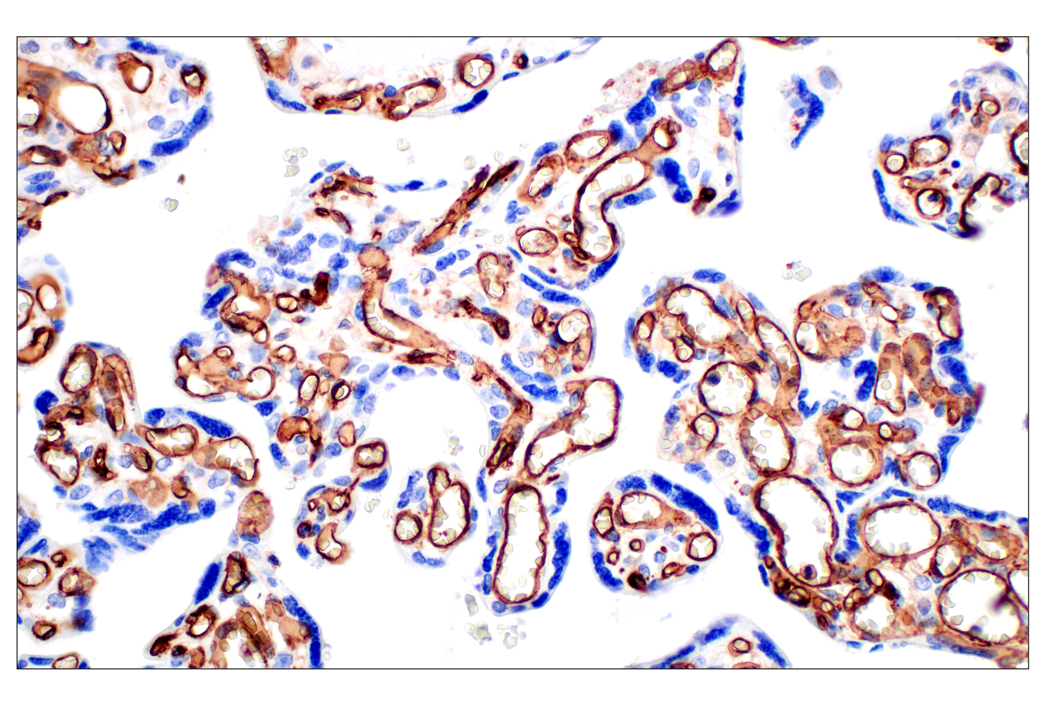 Immunohistochemistry Image 12: CD31 (PECAM-1) (F8M3S) Rabbit mAb (BSA and Azide Free)