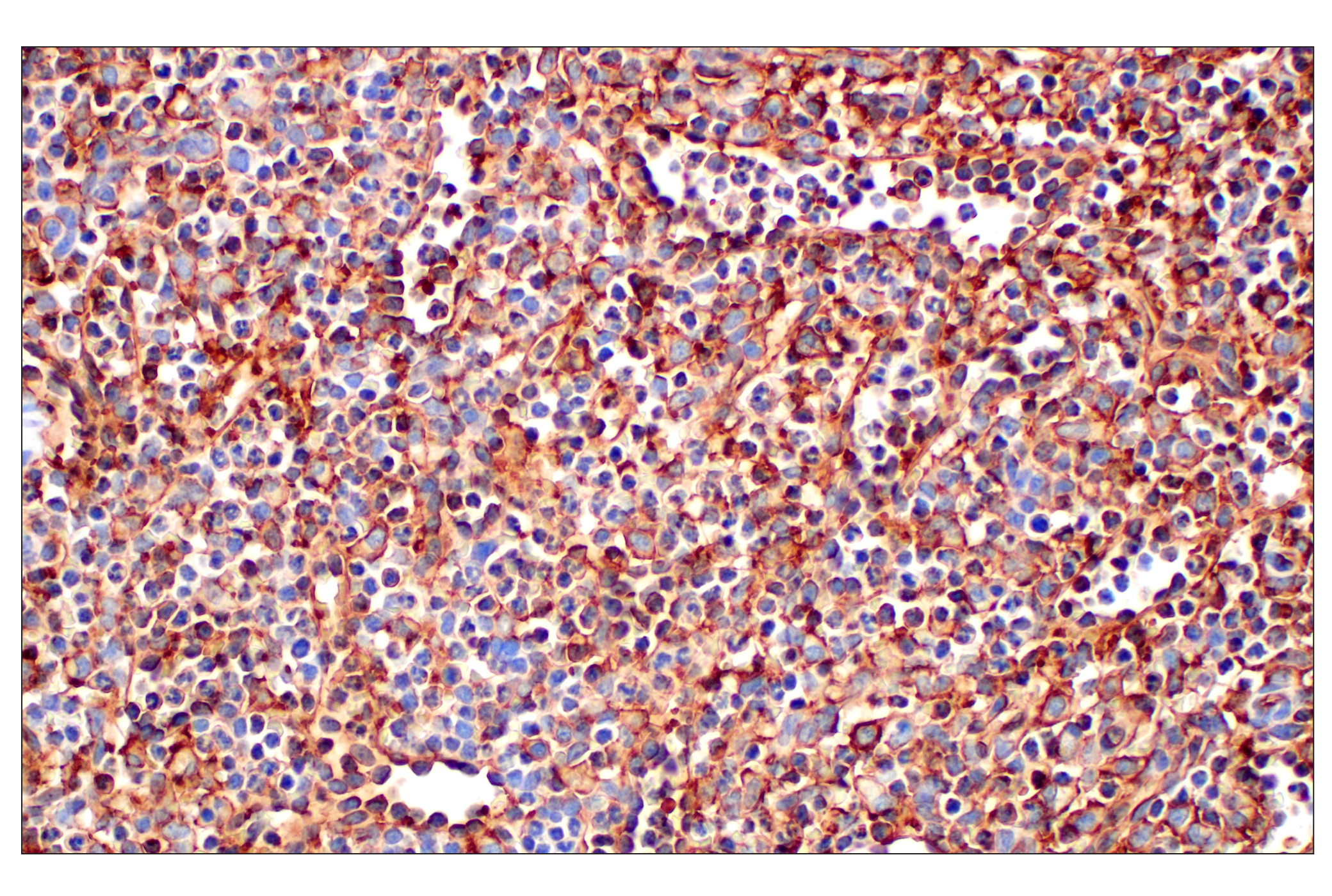 Immunohistochemistry Image 3: CD31 (PECAM-1) (F8M3S) Rabbit mAb (BSA and Azide Free)
