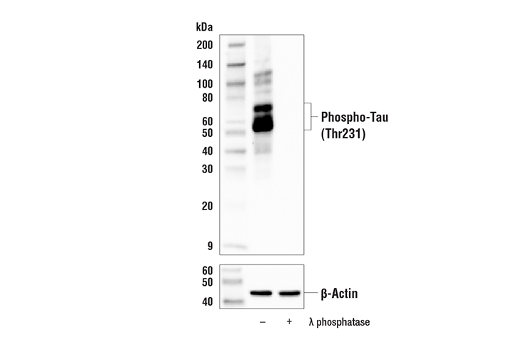 Western Blotting Image 1: Phospho-Tau (Thr231) Antibody