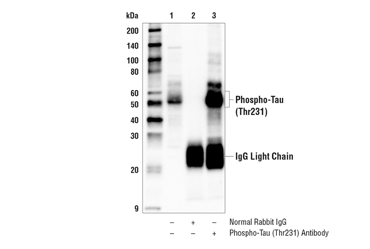 Immunoprecipitation Image 1: Phospho-Tau (Thr231) Antibody