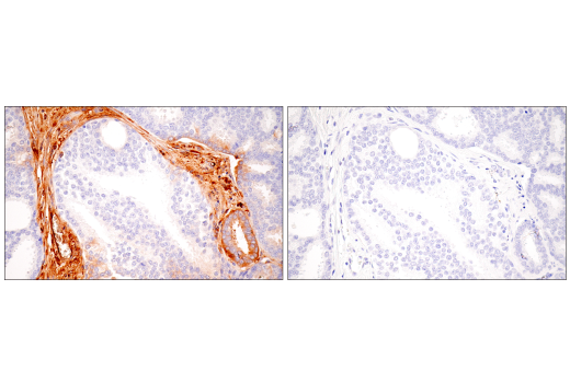 Immunohistochemistry Image 14: α-2-Macroglobulin (E6N7X) Rabbit mAb