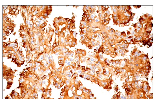 Immunohistochemistry Image 4: α-2-Macroglobulin (E6N7X) Rabbit mAb