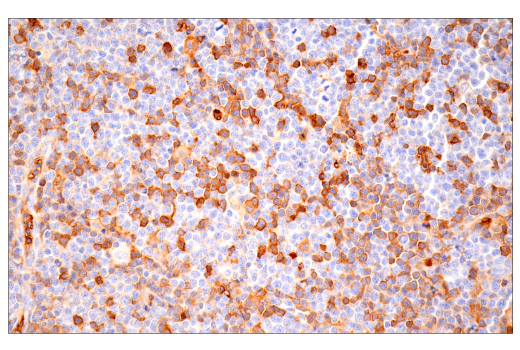 Immunohistochemistry Image 2: α-2-Macroglobulin (E6N7X) Rabbit mAb