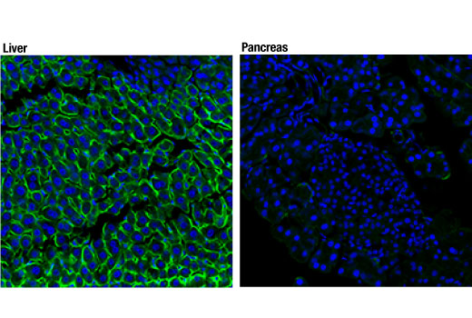 Immunofluorescence Image 1: EGF Receptor (D1P9C) Rabbit mAb