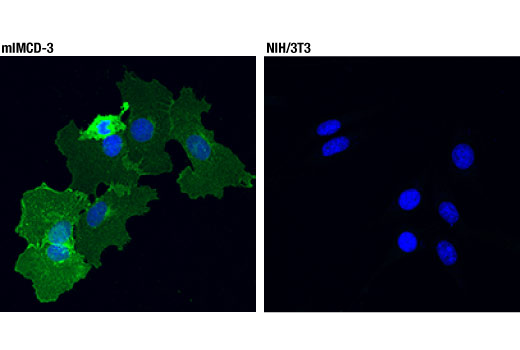Immunofluorescence Image 2: EGF Receptor (D1P9C) Rabbit mAb