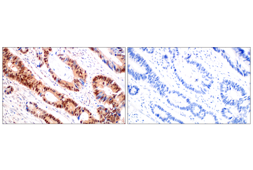  Image 32: PROTAC E3 Ligase Profiling Antibody Sampler Kit