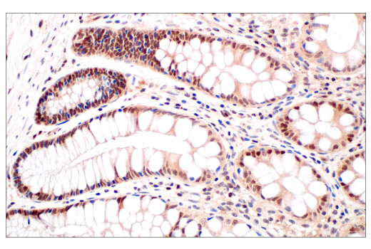  Image 25: PROTAC E3 Ligase Profiling Antibody Sampler Kit