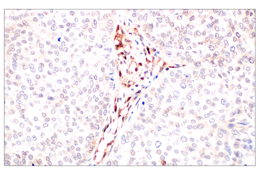  Image 21: PROTAC E3 Ligase Profiling Antibody Sampler Kit