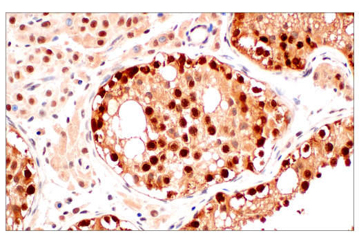  Image 27: PROTAC E3 Ligase Profiling Antibody Sampler Kit