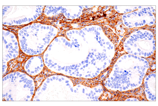  Image 21: Extracellular Matrix Dynamics Antibody Sampler Kit