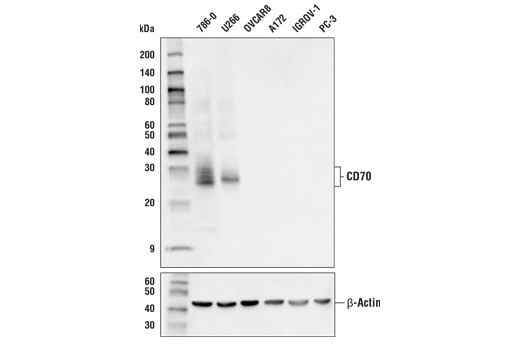 Western Blotting Image 1: CD70 Antibody