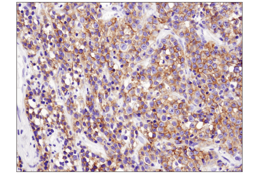 Immunohistochemistry Image 2: CXCR5 (D6L3C) Rabbit mAb