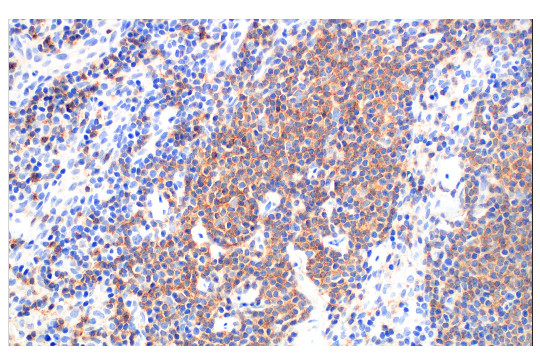 Immunohistochemistry Image 1: CXCR5 (D6L3C) Rabbit mAb