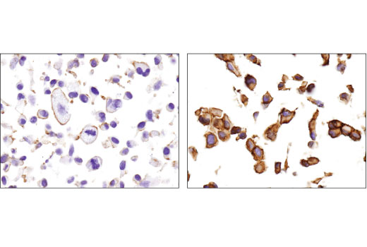 Immunohistochemistry Image 3: MRP1/ABCC1 (D5C1X) Rabbit mAb