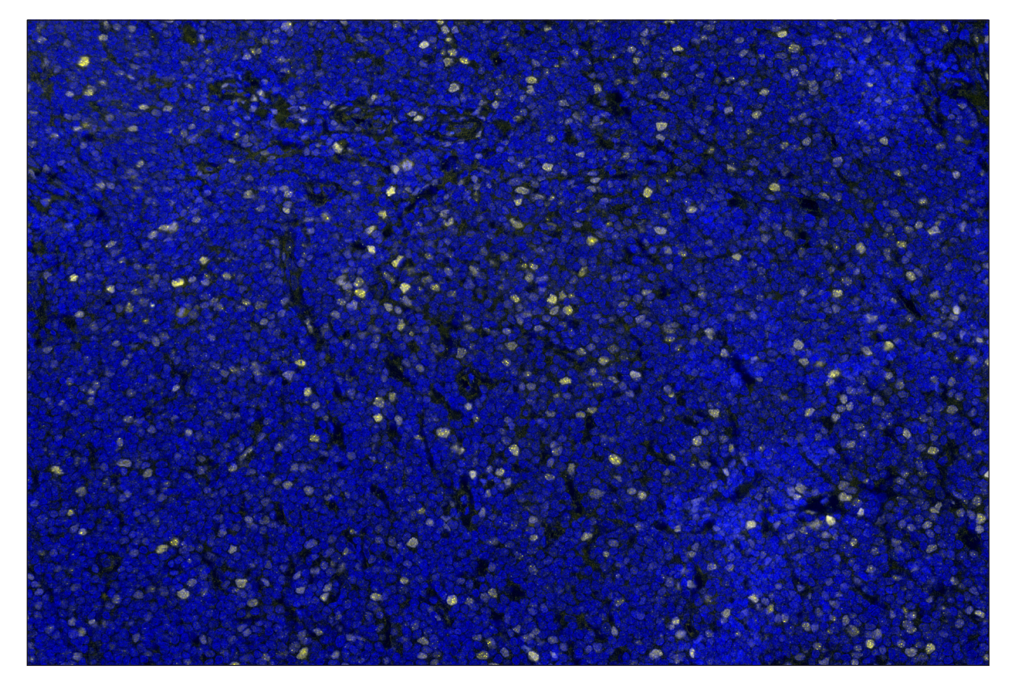 Immunohistochemistry Image 4: Ezh2 (D2C9) & CO-0167-594 SignalStar<sup>®</sup> Oligo-Antibody Pair