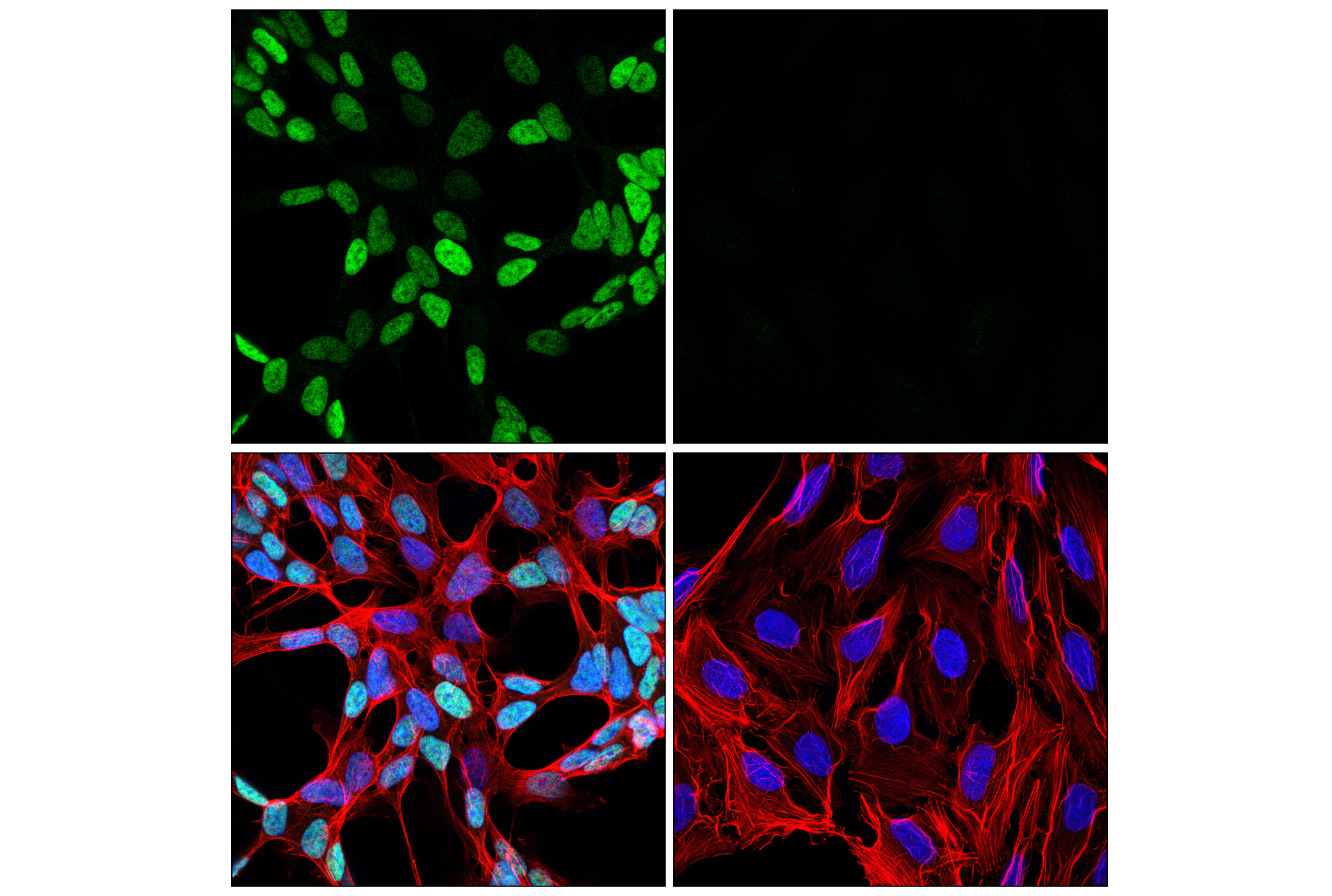 Immunofluorescence Image 1: GATA-2 (E8B5C) Rabbit mAb