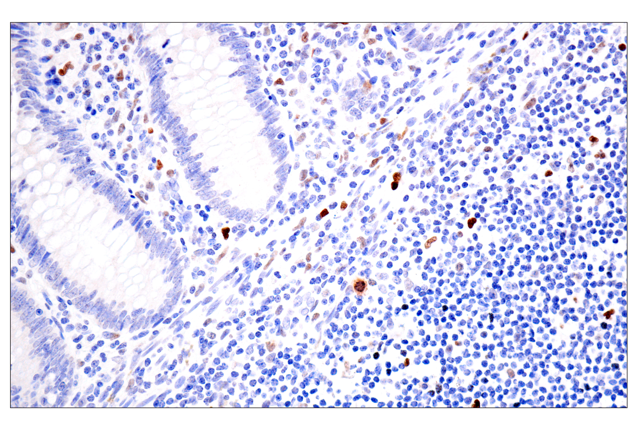 Immunohistochemistry Image 10: BATF3 (E3F3L) Rabbit mAb