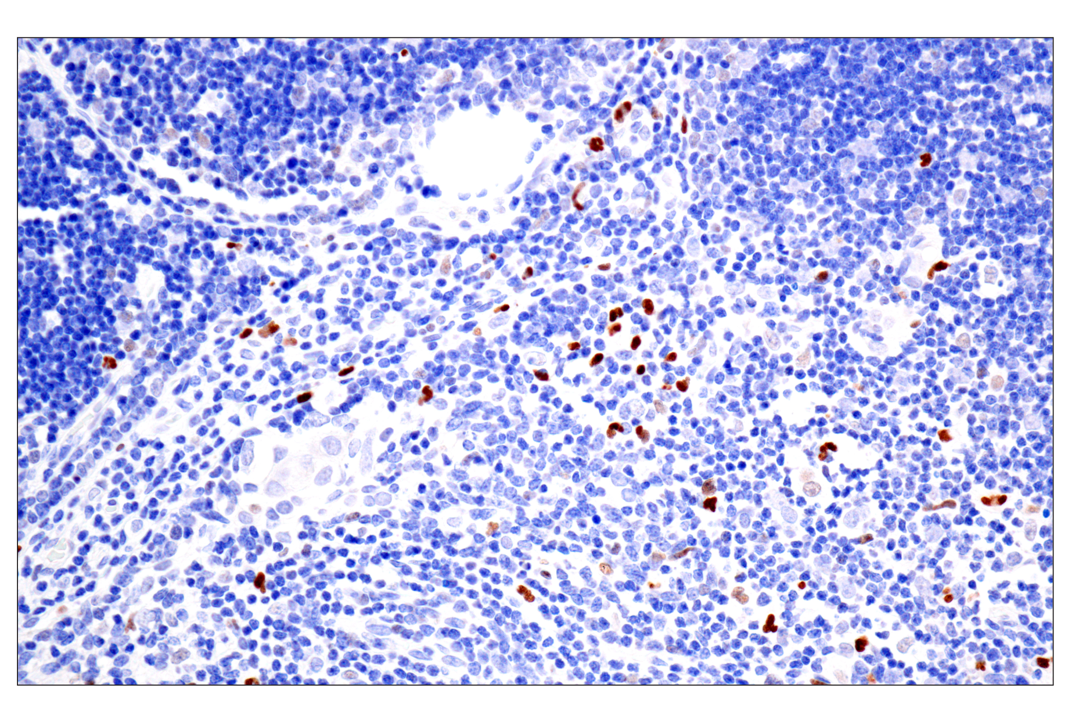 Immunohistochemistry Image 7: BATF3 (E3F3L) Rabbit mAb