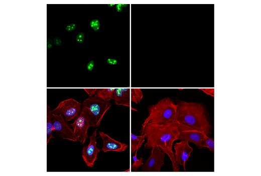 Immunofluorescence Image 1: p14 ARF (E3X6D) Rabbit mAb (Alexa Fluor® 488 Conjugate)