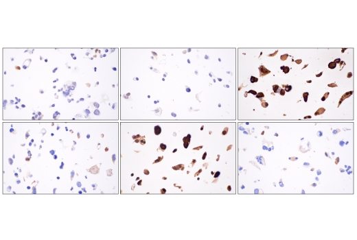 Immunohistochemistry Image 4: TAZ (E9J5A) XP® Rabbit mAb (BSA and Azide Free)