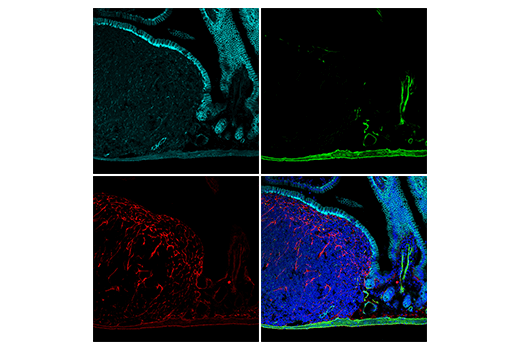 Immunofluorescence Image 2: COL1A1 (E8F4L) XP® Rabbit mAb (Alexa Fluor® 647 Conjugate)