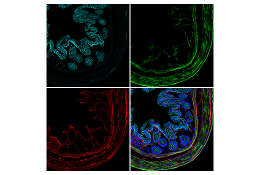 Immunofluorescence Image 3: COL1A1 (E8F4L) XP® Rabbit mAb (Alexa Fluor® 647 Conjugate)