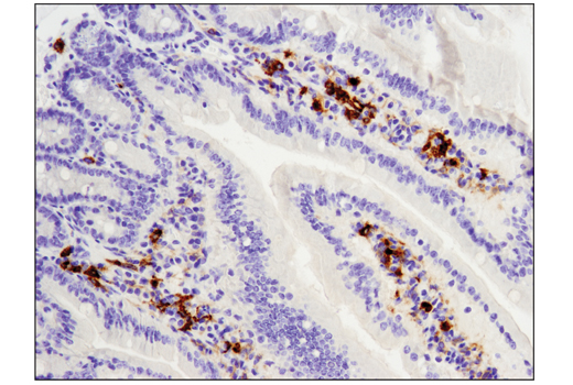 Immunohistochemistry Image 1: TIM-3 (D3M9R) XP® Rabbit mAb (BSA and Azide Free)