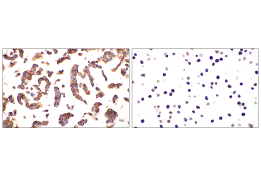  Image 51: Hypoxia Activation IHC Antibody Sampler Kit